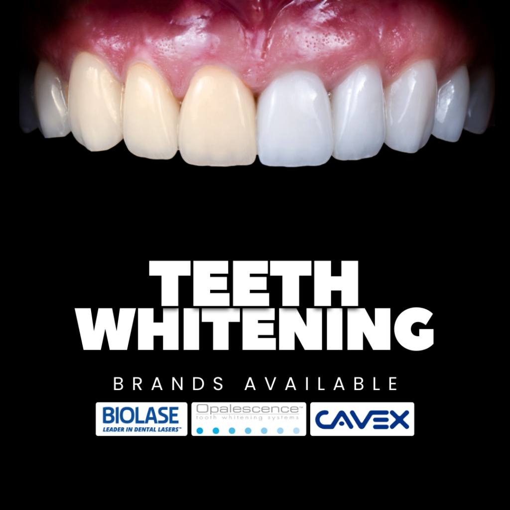 Teeth Whitening Cost in Kochi 2026: Get Your Dazzling Smile at Lavia Dental Care