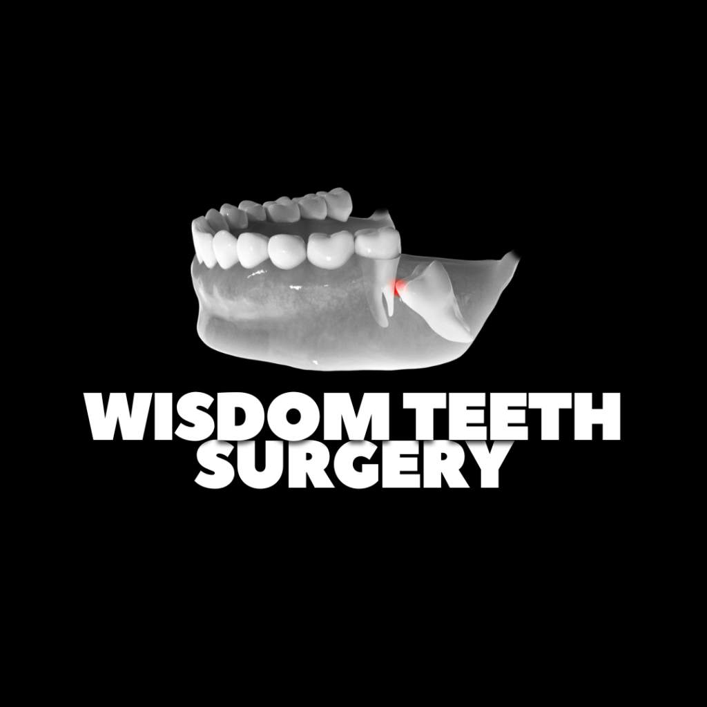 Wisdom Tooth Extraction in Kochi: 2026 Cost Guide & What to Expect at Lavia Dental Care