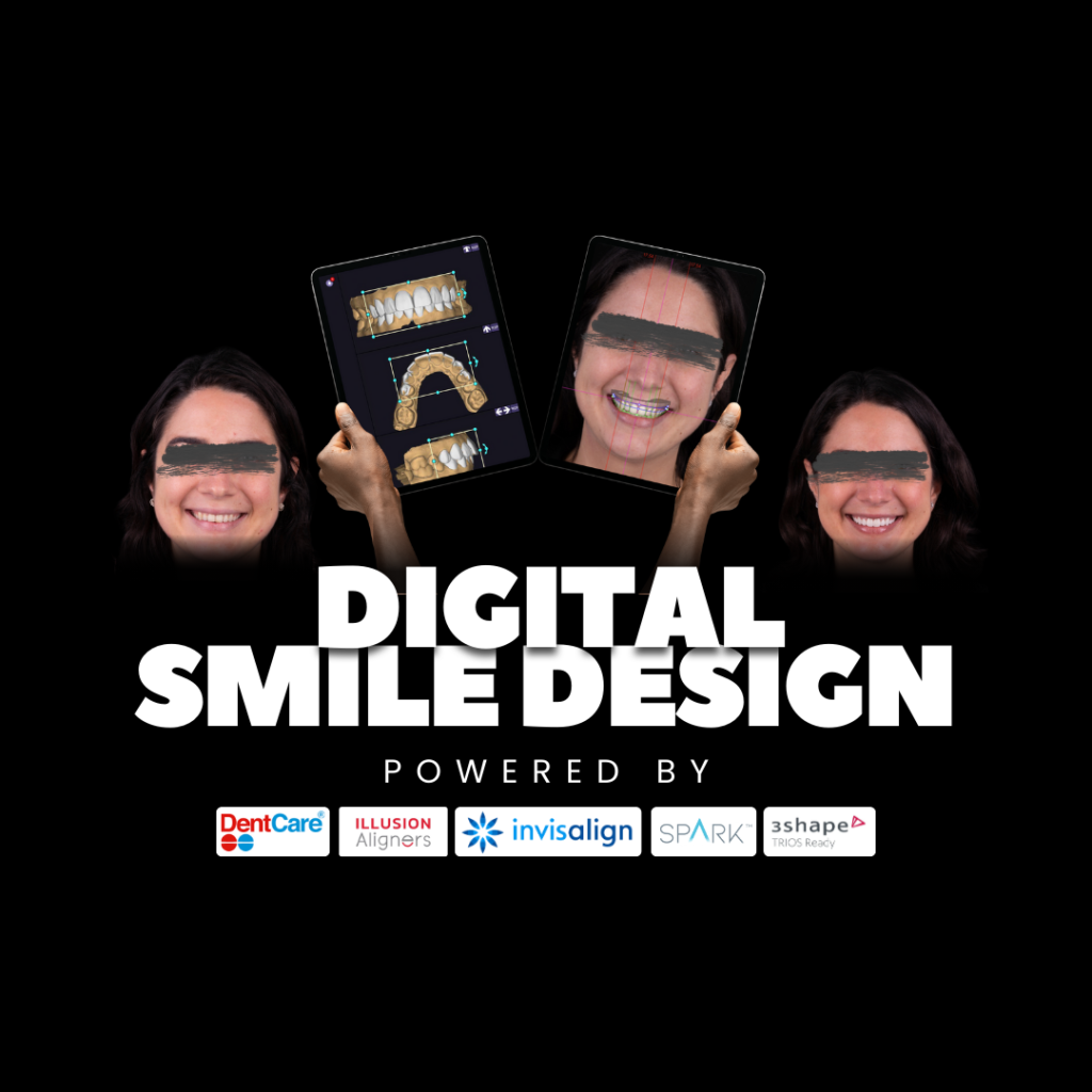 Smile Designing Cost in Kochi 2026: Your Complete Guide to a Perfect Smile at Lavia Dental Care