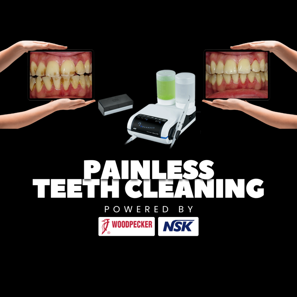 Teeth Cleaning Cost in Kochi (2026): A Complete Guide by Lavia Dental Care