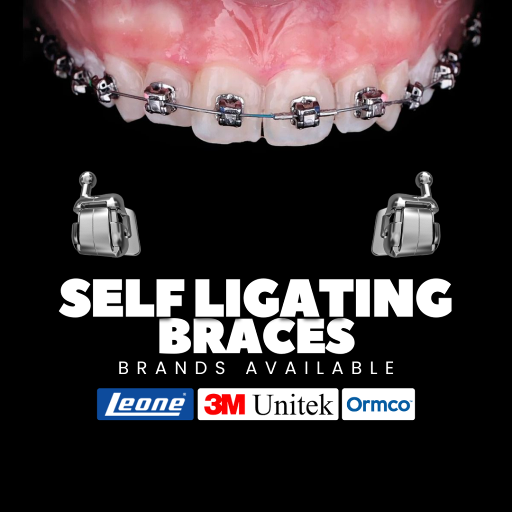 Dental Braces Cost in Kochi (2026 Guide): Everything You Need to Know at Lavia Dental Care